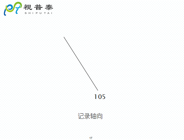 檢影鏡驗(yàn)光流程