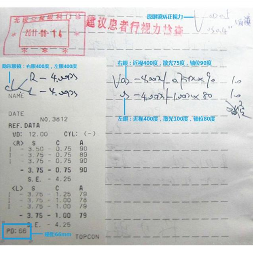 驗(yàn)光單怎么看