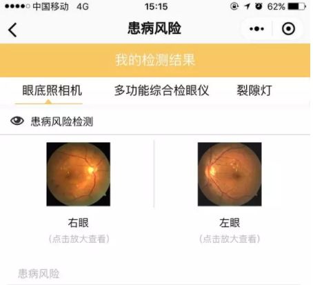 星創(chuàng)視界聯(lián)手春雨醫(yī)生，眼鏡店或成在線問診大入口