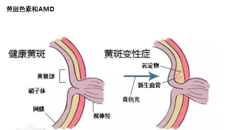 葉黃素是防止黃斑病變致老年失明的“視黃金”--驗(yàn)光師培訓(xùn)科普