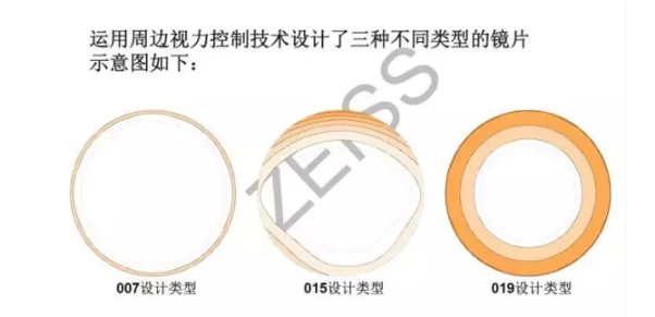 【驗光師分享】環(huán)焦、全焦和離焦這3種鏡片有什么區(qū)別？
