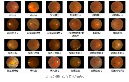 視光變革者寶島眼鏡CEO王智民：AI是慢性病、近視防控救星