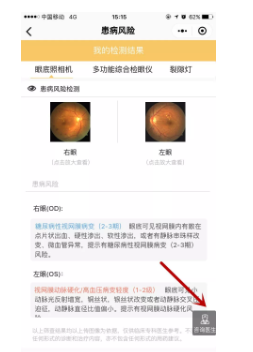 視光變革者寶島眼鏡CEO王智民：AI是慢性病、近視防控救星