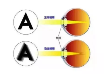 東莞驗(yàn)光師考證培訓(xùn)散光如何正確應(yīng)對(duì)？