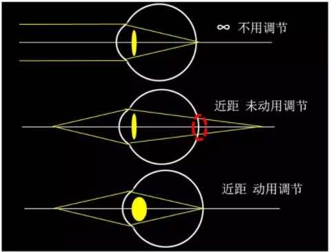 東莞驗光師培訓(xùn)課程