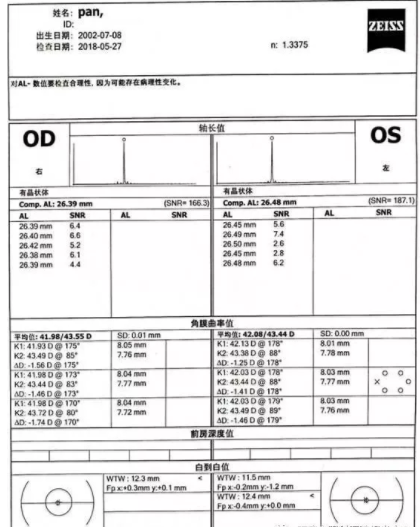 高度近視患者配戴角膜塑形鏡的效果觀察