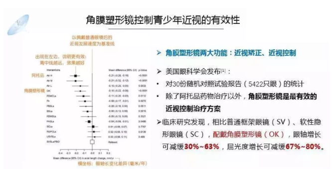 【眼視光前沿】一種具有非球面基弧設(shè)計(jì)的角膜塑形鏡
