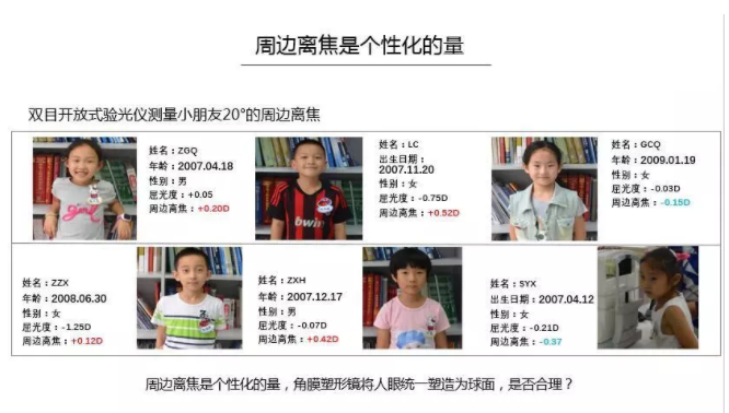 【眼視光前沿】一種具有非球面基弧設(shè)計的角膜塑形鏡