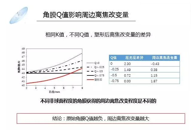 【眼視光前沿】一種具有非球面基弧設(shè)計的角膜塑形鏡