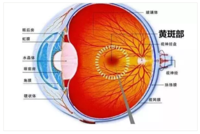 【驗光師培訓科普】一組圖告訴你的眼底還健康嗎？